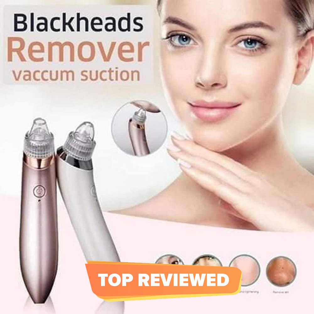 Electric Suction Blackhead Instrument Home Beauty Instrument Blackhead Pore Cleaning